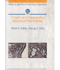 Cystic and dysplastic lesions of the kidney