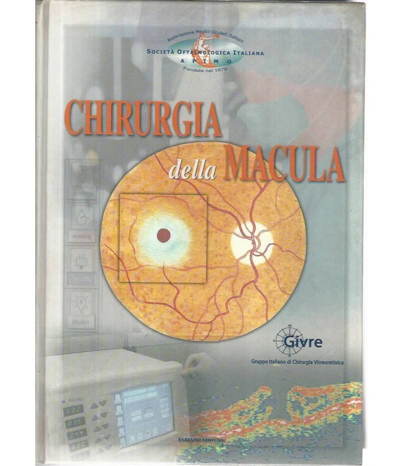 Chirurgia della macula