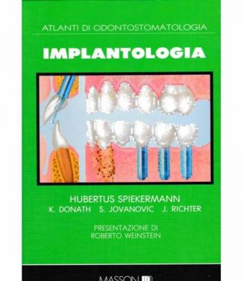 Atlanti di Odontostomatologia. Implantologia