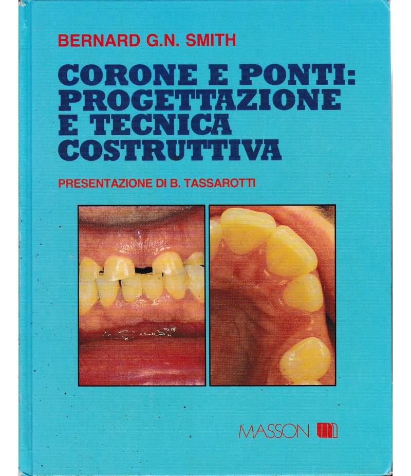 Corone e ponti: progettazione e tecnica costruttiva