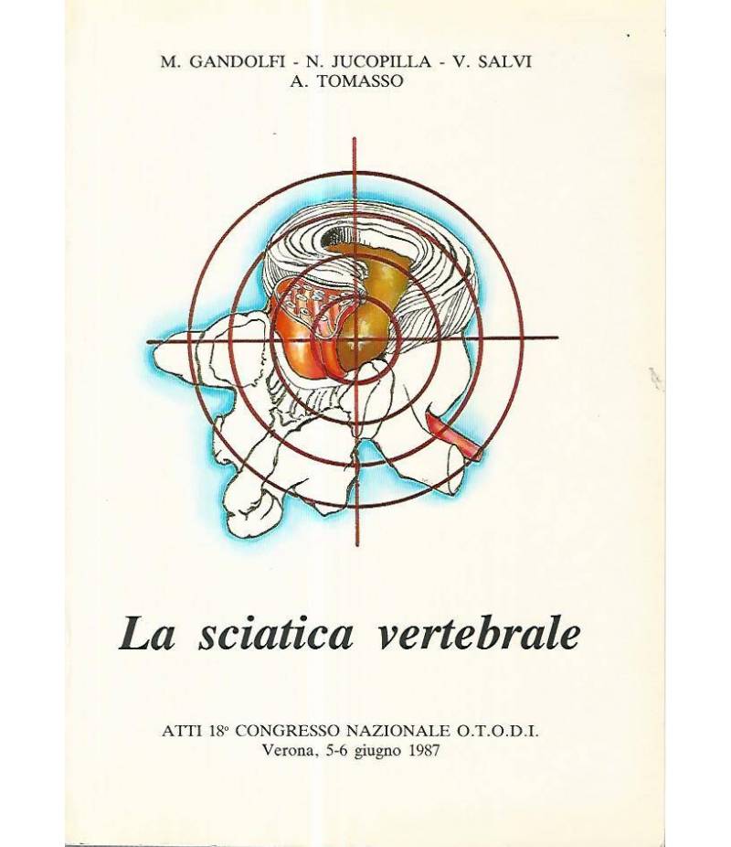 La sciatica vertebrale